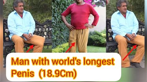 longest penus ever|Man shares struggles of living with one of the world's largest .